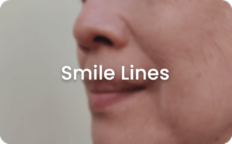 skin concerns