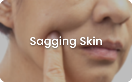 skin concerns