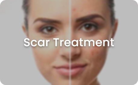 skin concerns