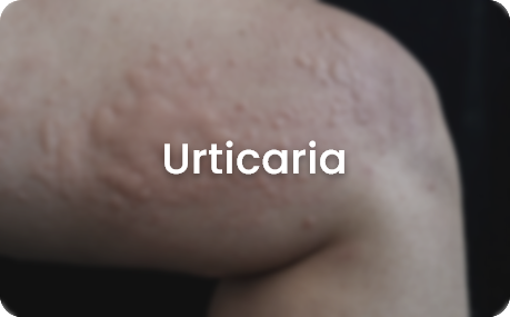skin concerns