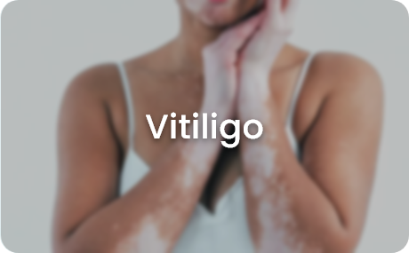 skin concerns