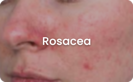 skin concerns