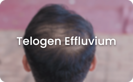 skin concerns