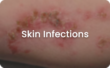 skin concerns
