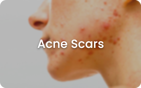 skin concerns