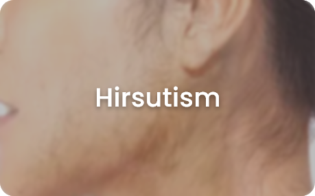 skin concerns