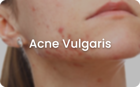 skin concerns