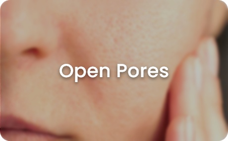 skin concerns