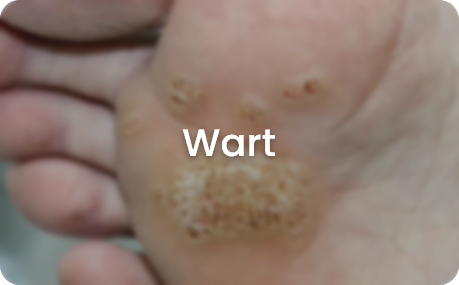 skin concerns