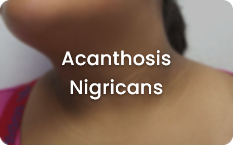 skin concerns