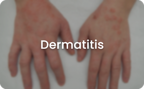 skin concerns