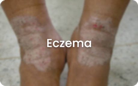 skin concerns