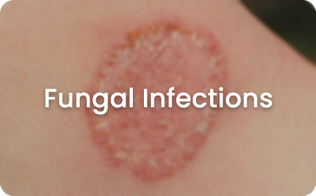 skin concerns