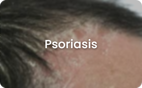 skin concerns