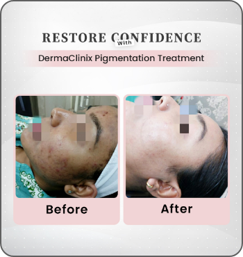 hair transplant results