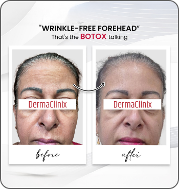 hair transplant results