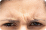 area-botox-section
