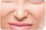 area-botox-section