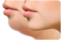 area-botox-section