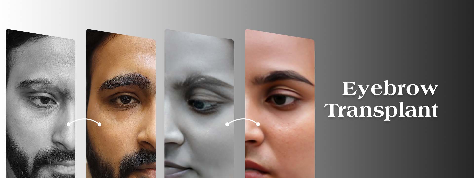 eyebrow transplant banner