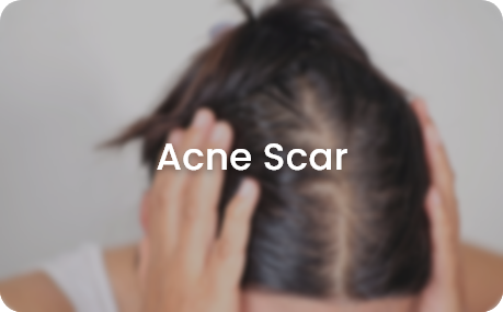 Skin Page